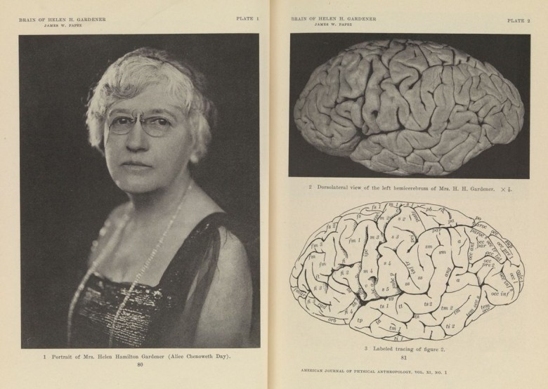 Helen Hamilton Gardener y su cerebro. American journal of physical anthropology