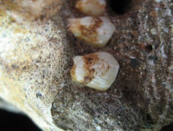 Mandíbula superior del homínido de Malapa, con placa en premolar. © Amanda Henry 