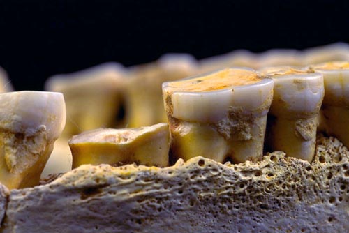 Desgaste dental (Juan Luis Arsuaga, UCM).