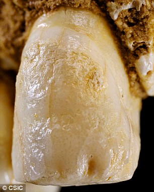 Diente de la mandíbula de un neandertal (cueva de El Sidrón).