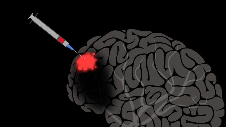 El cerebro puede autorrepararse con ayuda