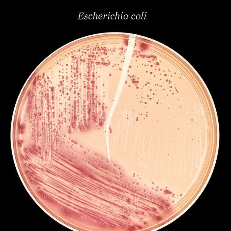 800px-Escherichia_coli_(MCC)