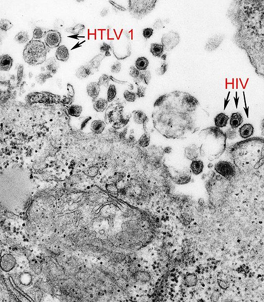523px-HTLV-1_and_HIV-1_EM_8241_lores