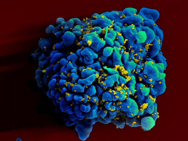 HIV-infected_H9_T_cell