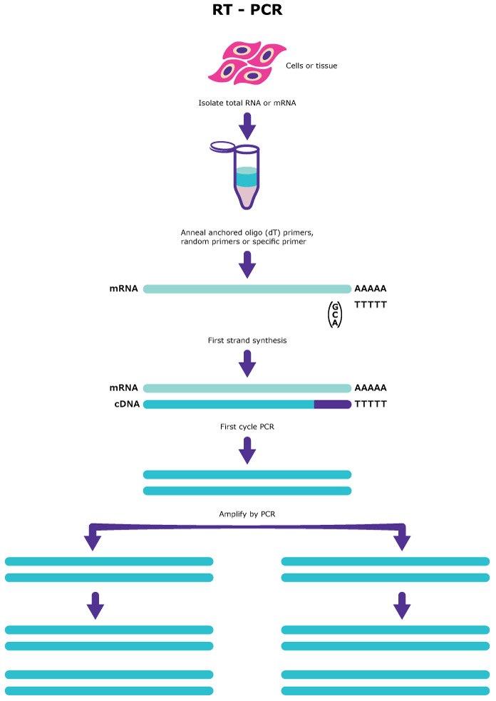 RT-PCR steps from RNA isolation to amplification