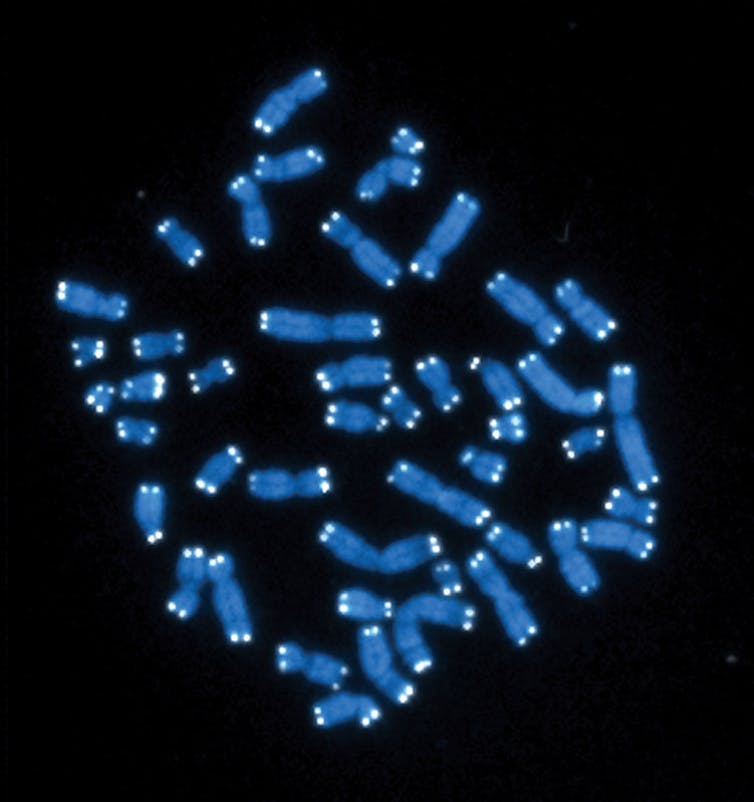 46 cromosomas humanos coloreados en azul con telómeros blancos contra una pantalla negra