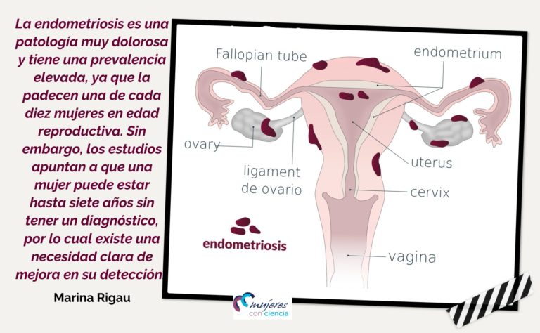 Mejorar la detección de la endometriosis