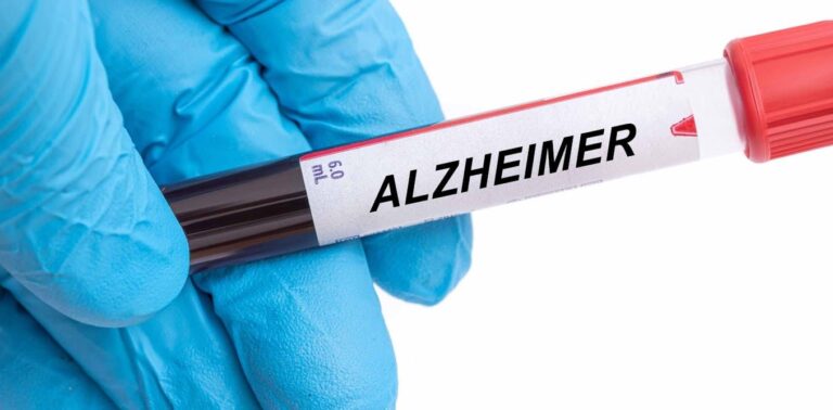 Análisis de sangre para predecir el alzhéimer: comienza una nueva era en la prevención