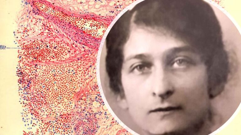 Gabrielle Charlotte Lévy, la neuróloga de las “estatuas vivientes”