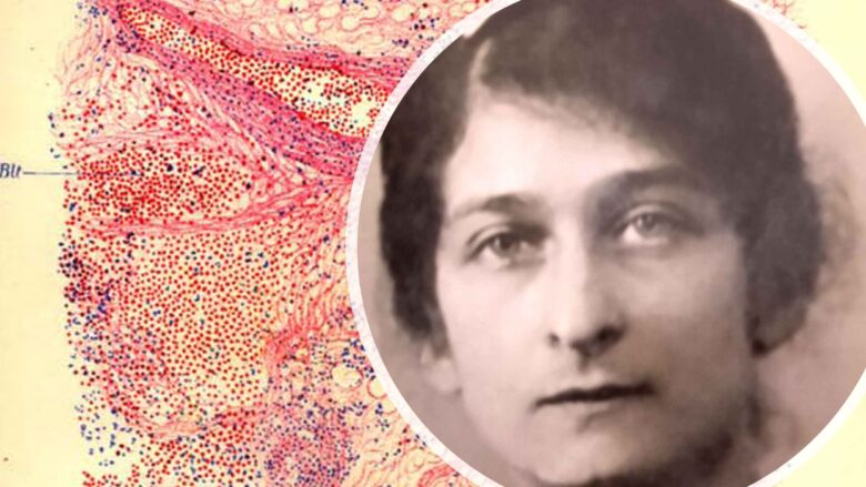 Gabrielle Charlotte Lévy, la neuróloga de las “estatuas vivientes”